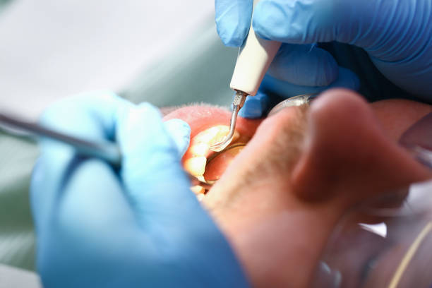 Best Emergency Treatment for Dental Infections or Abscesses in Sur Hill, GA
